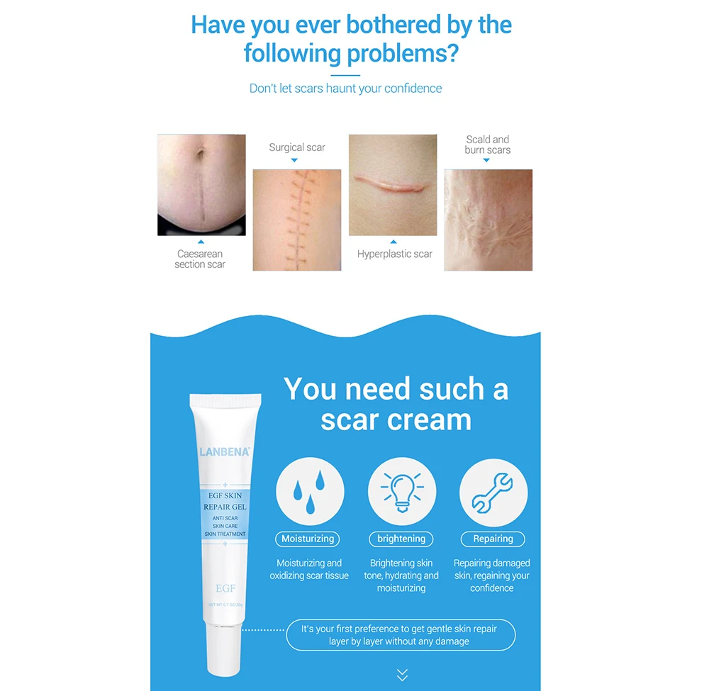 Удаление Шрама от акне крем средство для удаления растяжек пятен лечение