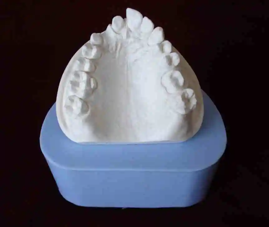 

KeyWord: dental implants; denture; dental prostheses;