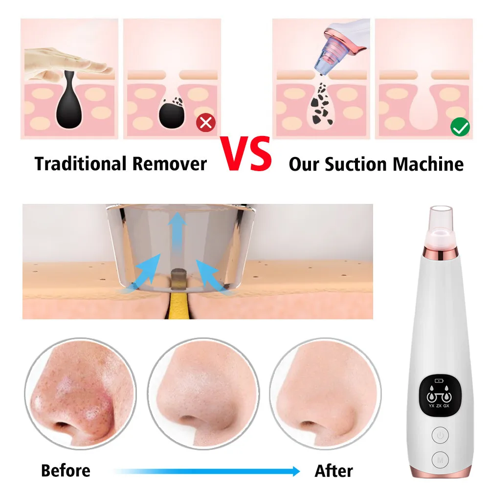 Устройство для удаления угрей Электрический вакуумный очиститель пор лица