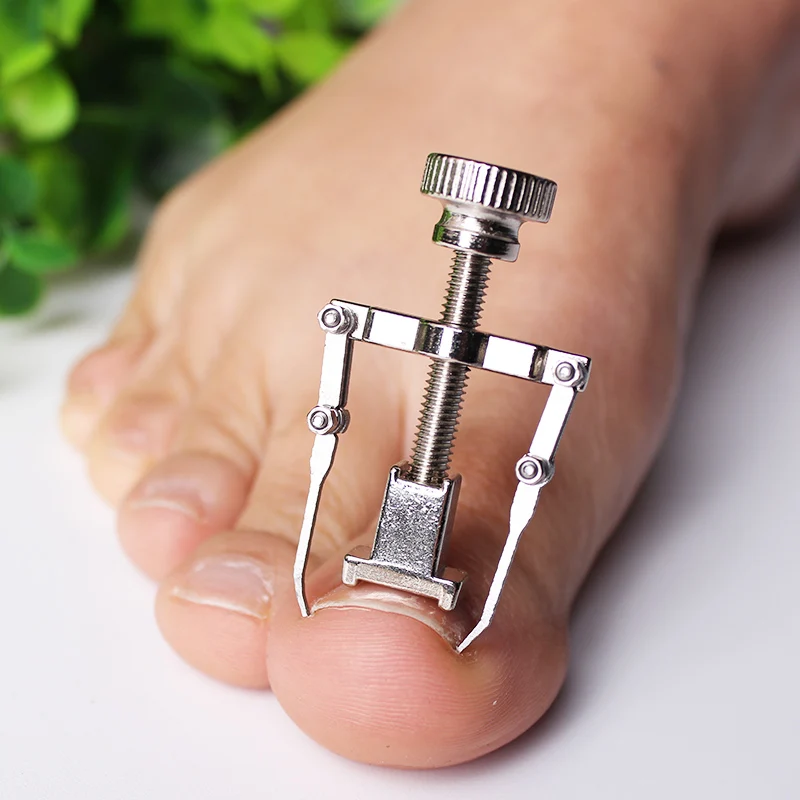 Средство для педикюра корректор бурсита инструмент восстановления вросших