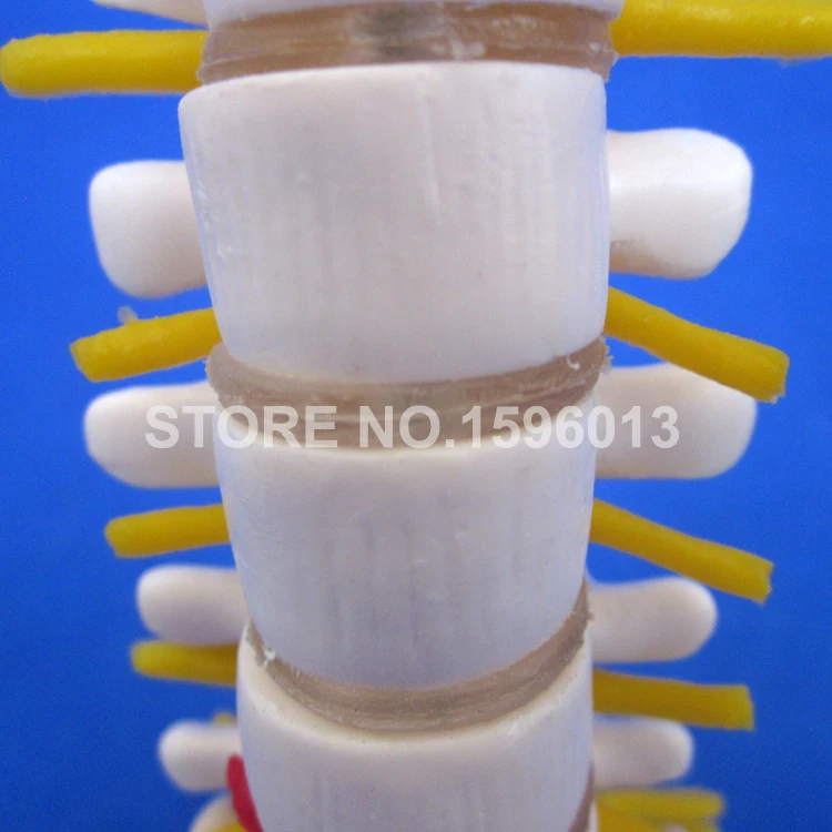 Мини поясничная модель позвонка с крестиком коциксом и грыжевым диском поясным