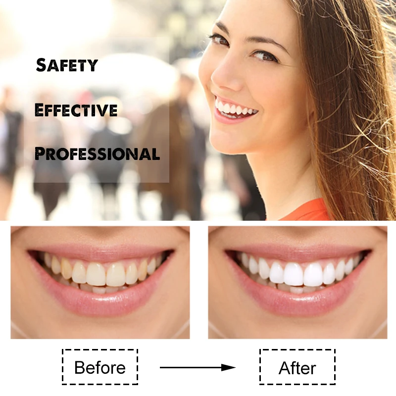 Dental Profesional  Activated Charcoal Teeth Whitening Strips  Effects 14 Days Oral Hygiene Care White Strip images - 6