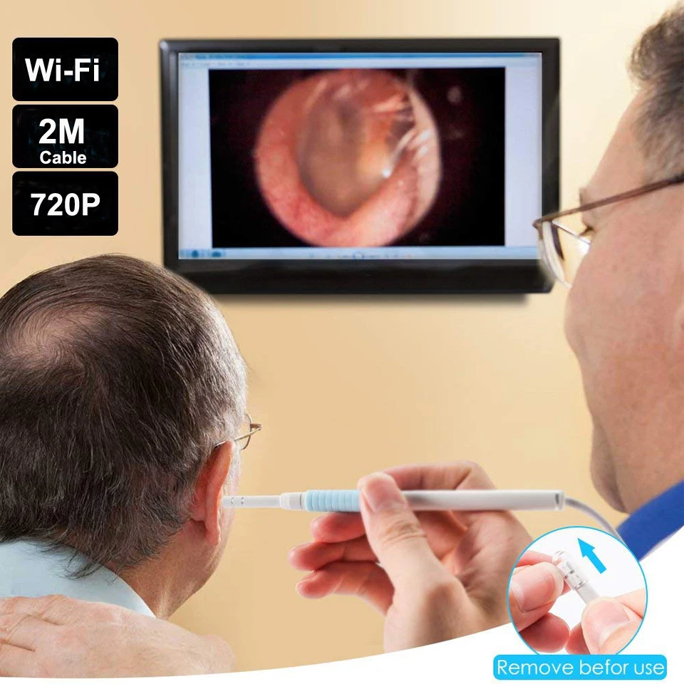 Беспроводной Эндоскоп для очистки ушей Wi Fi бороскоп HD 720 P медицинская