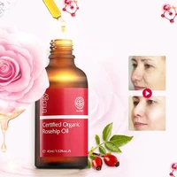 newzealand trilogy certified organic rosehip oil 45ml for scars fine lines wrinkle stretch marks dehydrated ageing skin