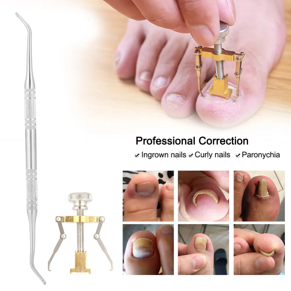 2 шт. пилка для вросших ногтей из нержавеющей стали|Принадлежности дизайна