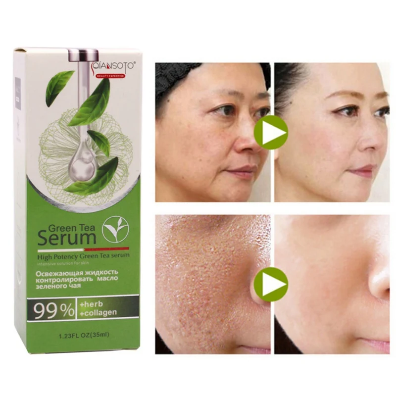 Сывороточная эссенция восстановление и Отбеливание лица с зеленым чаем