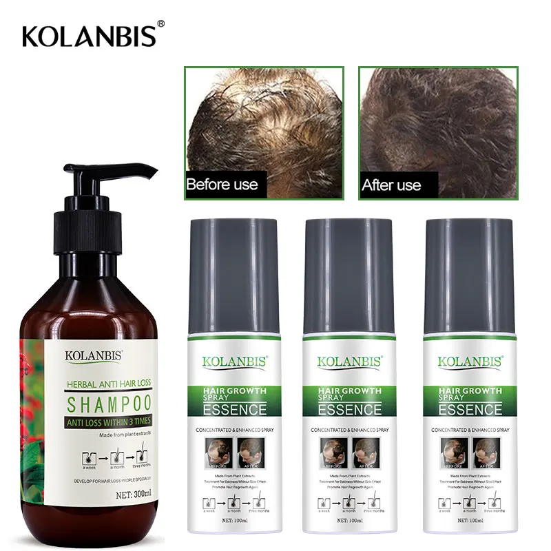 

4pc oily growth bald spray tonic and ginseng hair loss regrowth shampoo for alopecia men fast follicle treatment essential oils