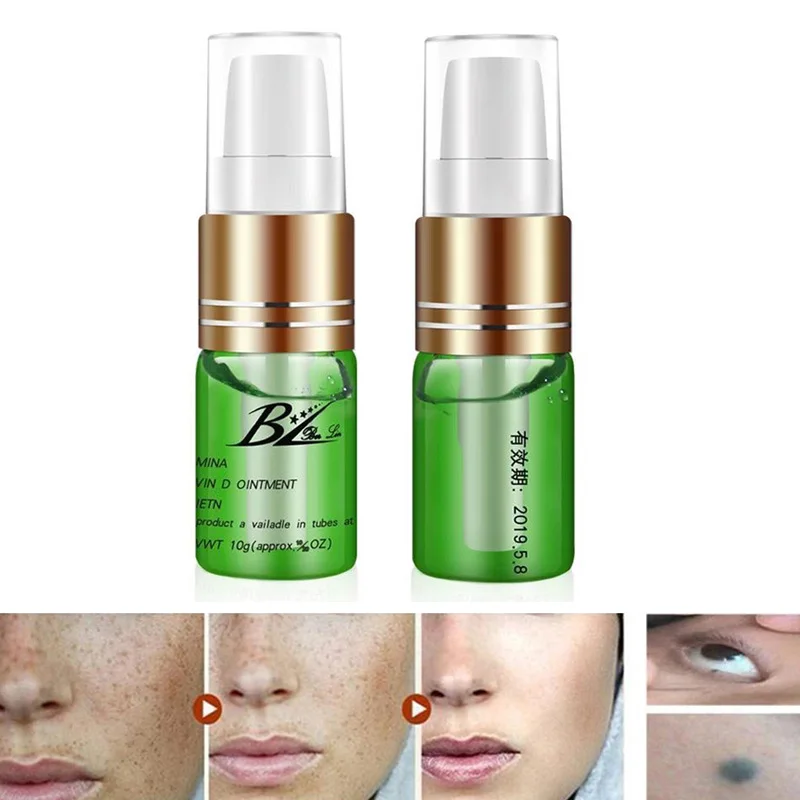 

1 Pcs Skin Tag Repair Liquid Mole Skin Dark Spot Repair for Face Wart Tag Freckle SSwell