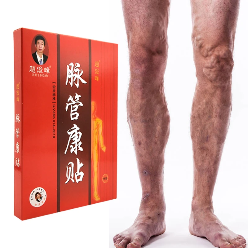 

24PCS Chinese Traditional herbal medicine Patches Cure Spider Veins Varicose Treatment Plaster Varicose Veins Vasculitis Natural