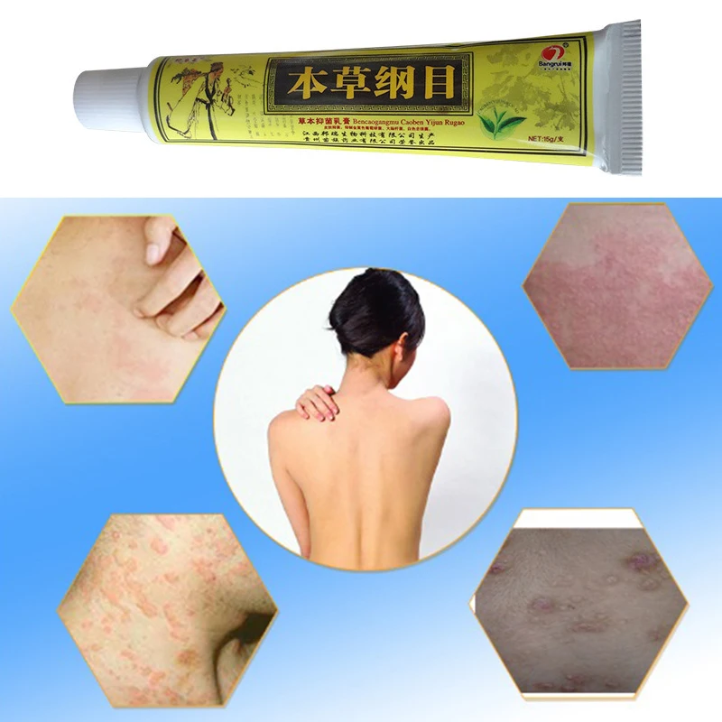 

15g Psoriasis Cream for Dermatitis and Eczema Pruritus Psoriasis Ointment Herbal Creams Dropshipping