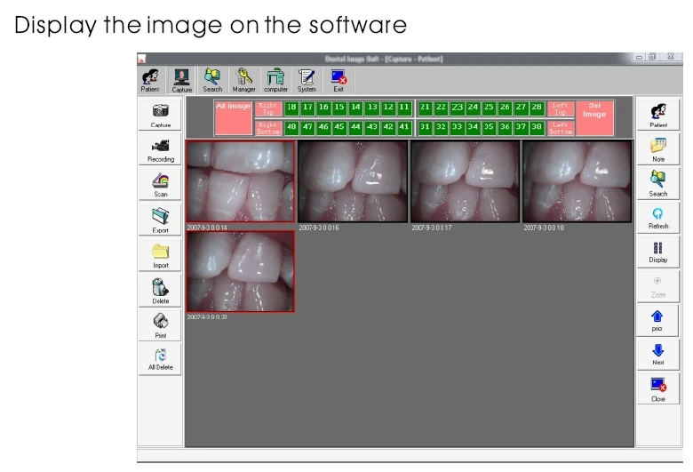 OC-2 стоматологическая интраоральная камера OralCareTeeth WhiteningThe профессиональная стоматологическая интраоральная камера