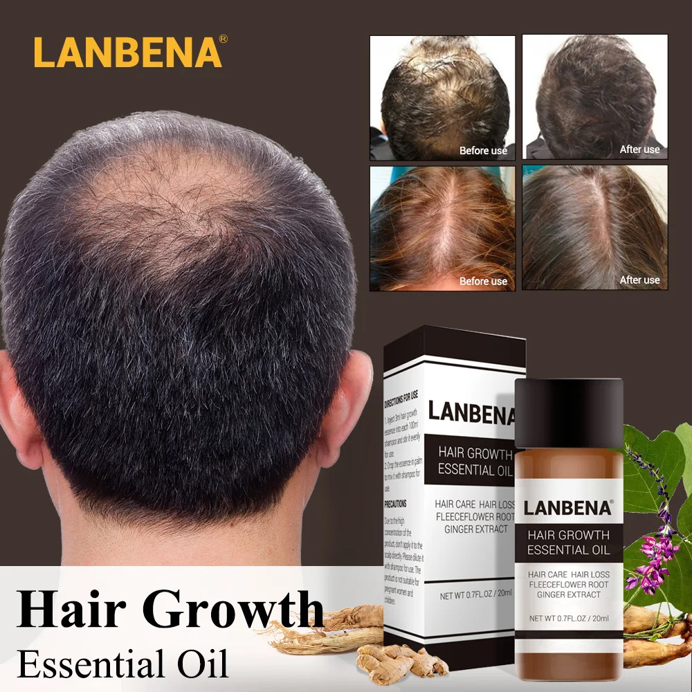 LANBENA 20 мл эссенция для роста волос предотвращающая выпадение жидкость женщин и