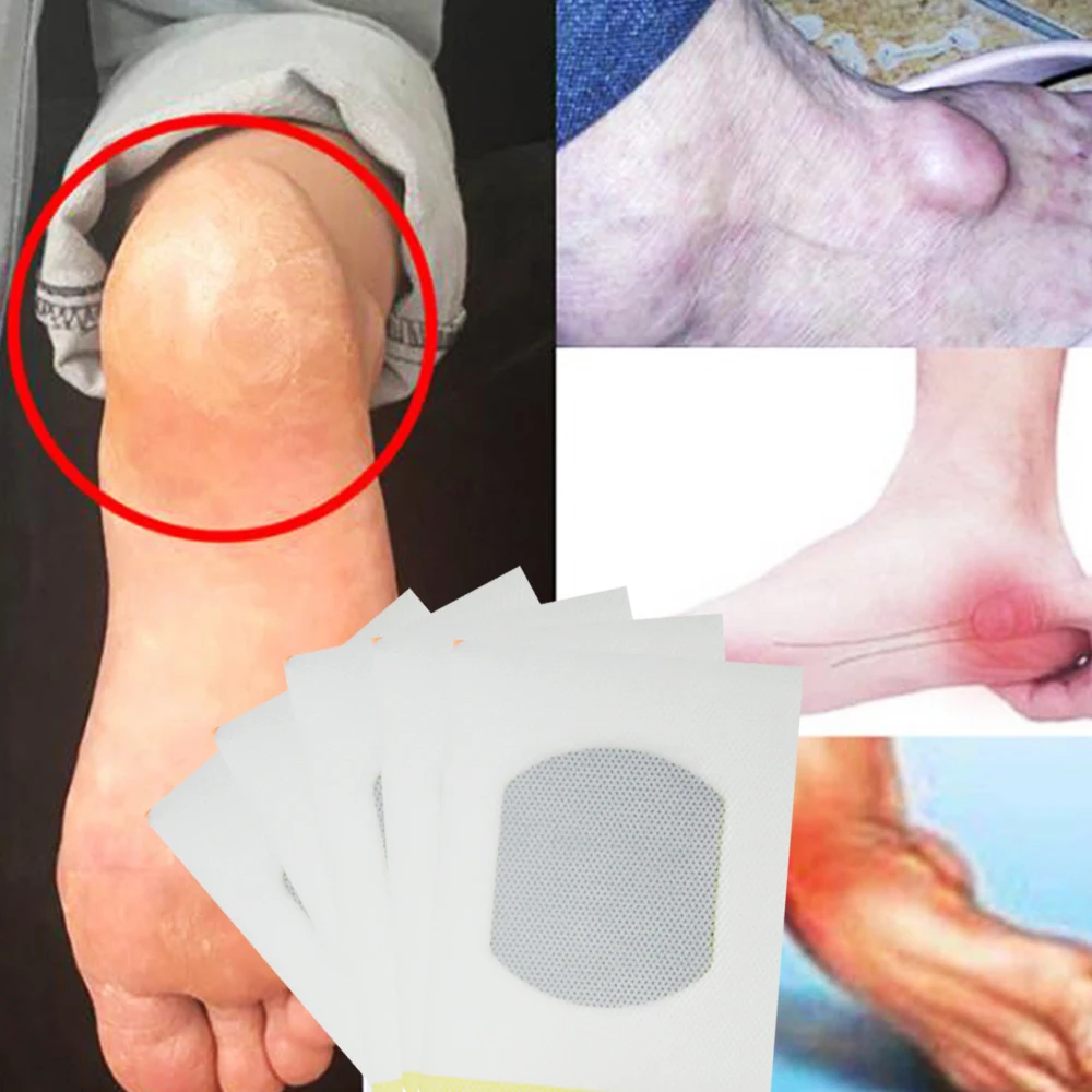 Травяные Пластыри для облегчения боли в костях 4 шт.|Пластыри терапевтические| |