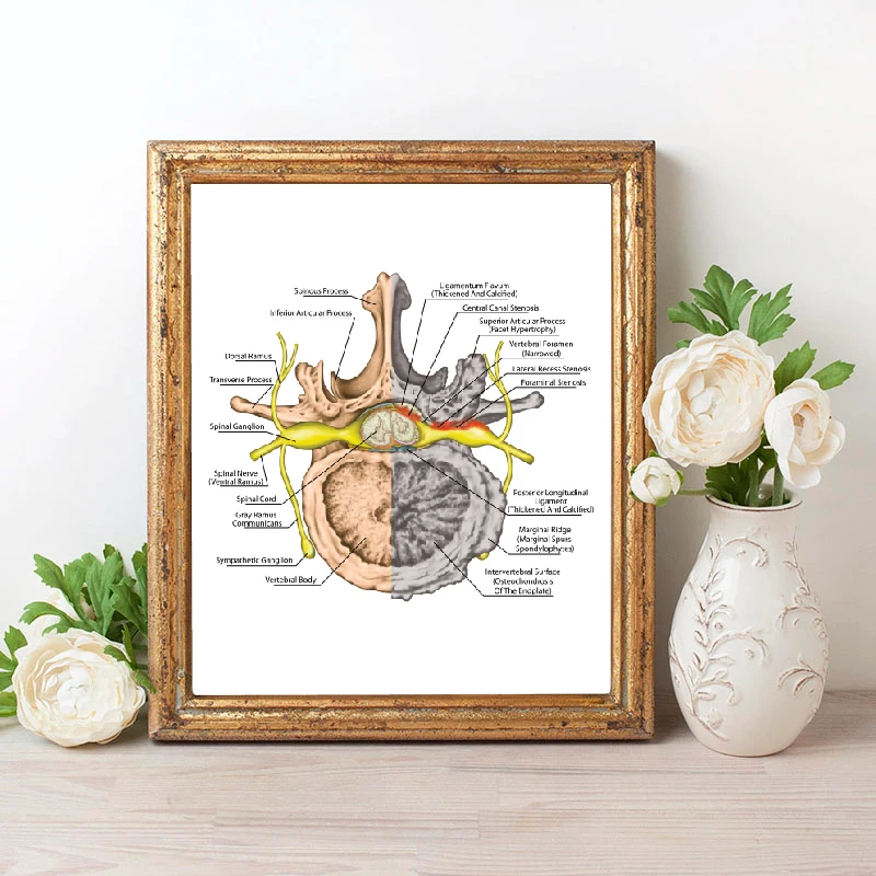 Ортопедическая компьютерная система человека постер с изображением