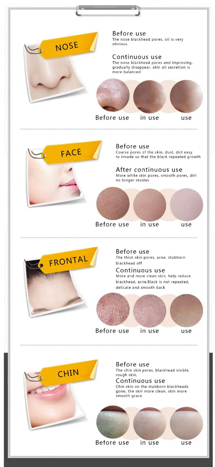PILATEN Уход за кожей набор черный маска угорь Уход за кожей лица маска акне и губ collagen crystal mask увлажняющий сексуальный бюстгальтер Средства ухода за губами маска