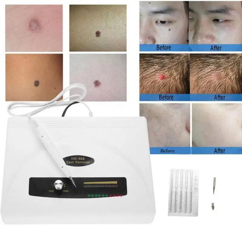 Ультразвуковая ручка для удаления пятен большая мощность веснушка татуировка