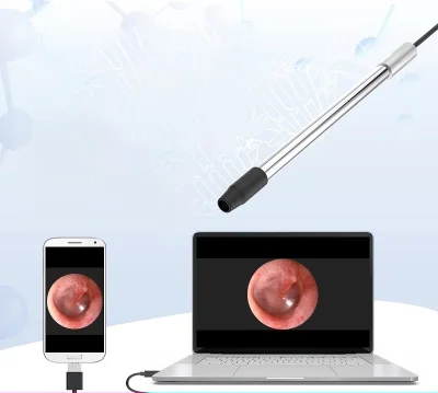 Otolaryngology эндоскоп oralexam инструмент cervix электронный кольпоскоп зеркало камера