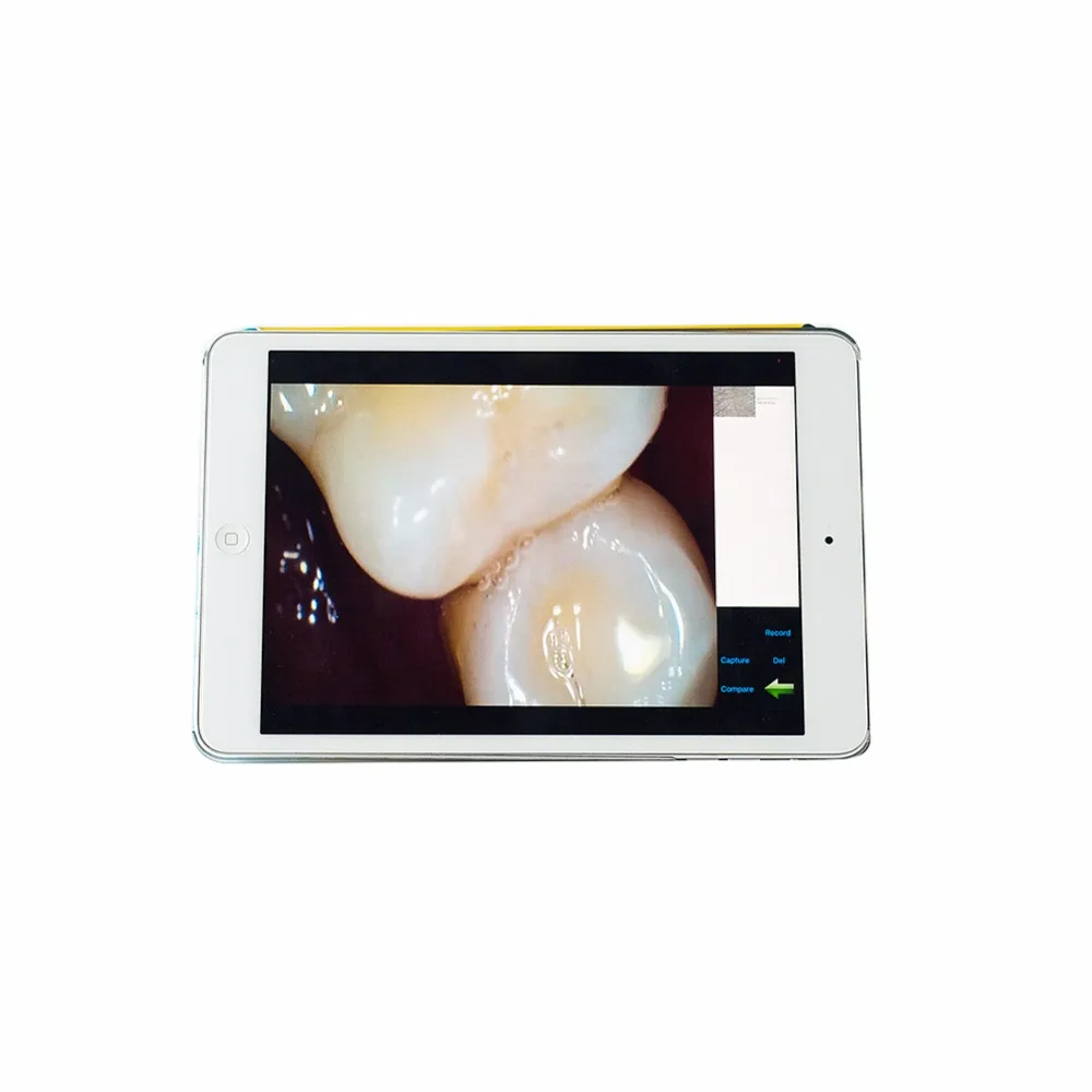 EASYINSMILE стоматологическая интраоральная камера беспроводная HD с высоким