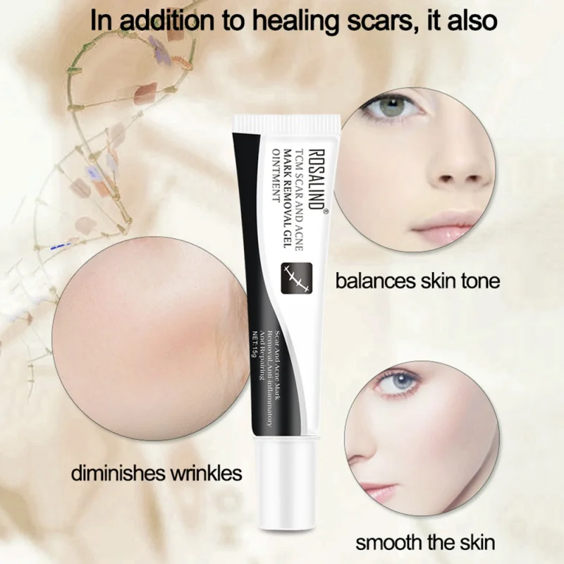 Acne Scar Removal Cream Skin Repair Face Spots Treatment Blackhead Whitening Stretch Marks | Красота и здоровье