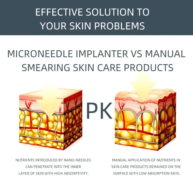 Электрический Дерма ручка Профессиональный беспроводной Уход за кожей набор