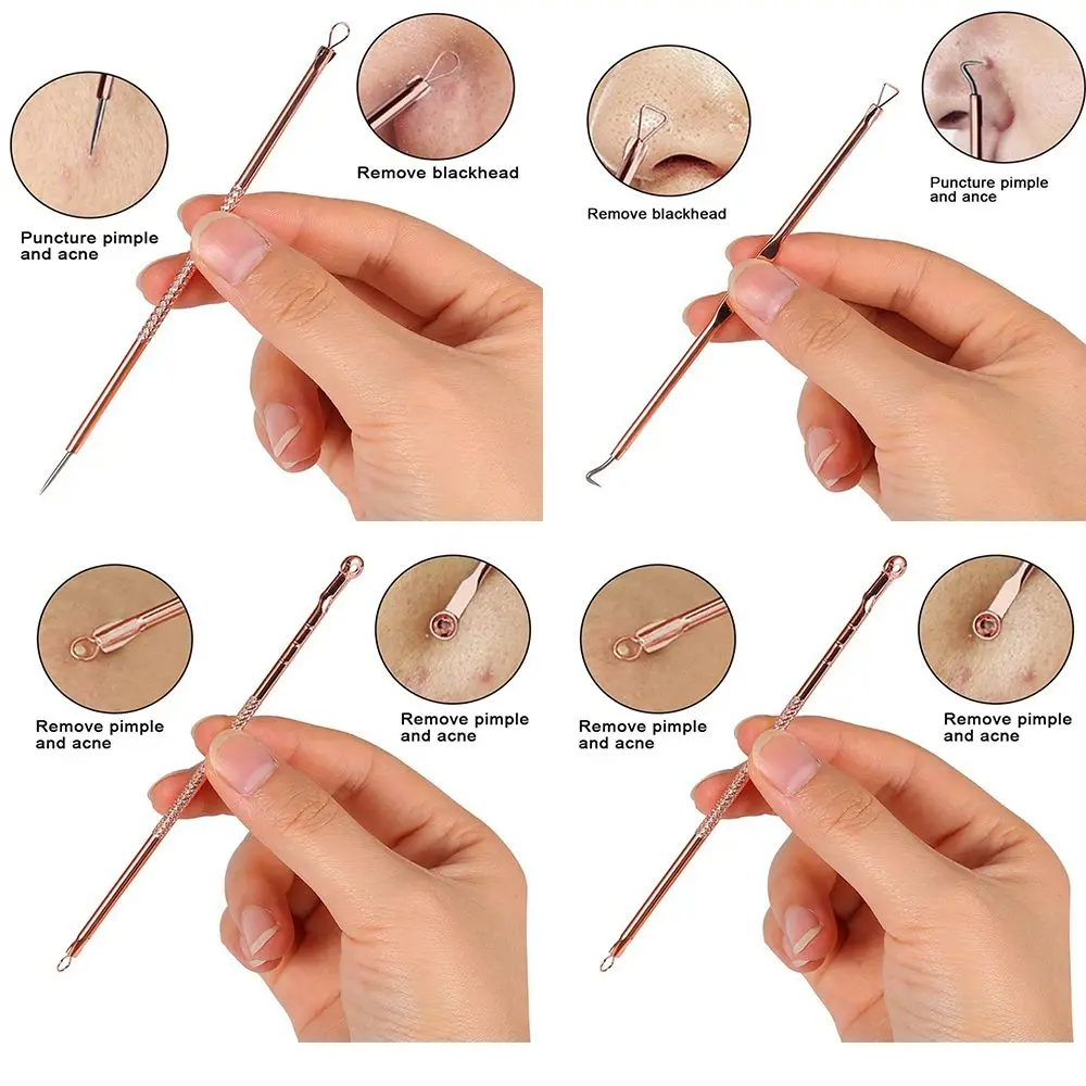 1 комплект Лидер продаж средство для удаления чёрных точек прыщей и комедонов