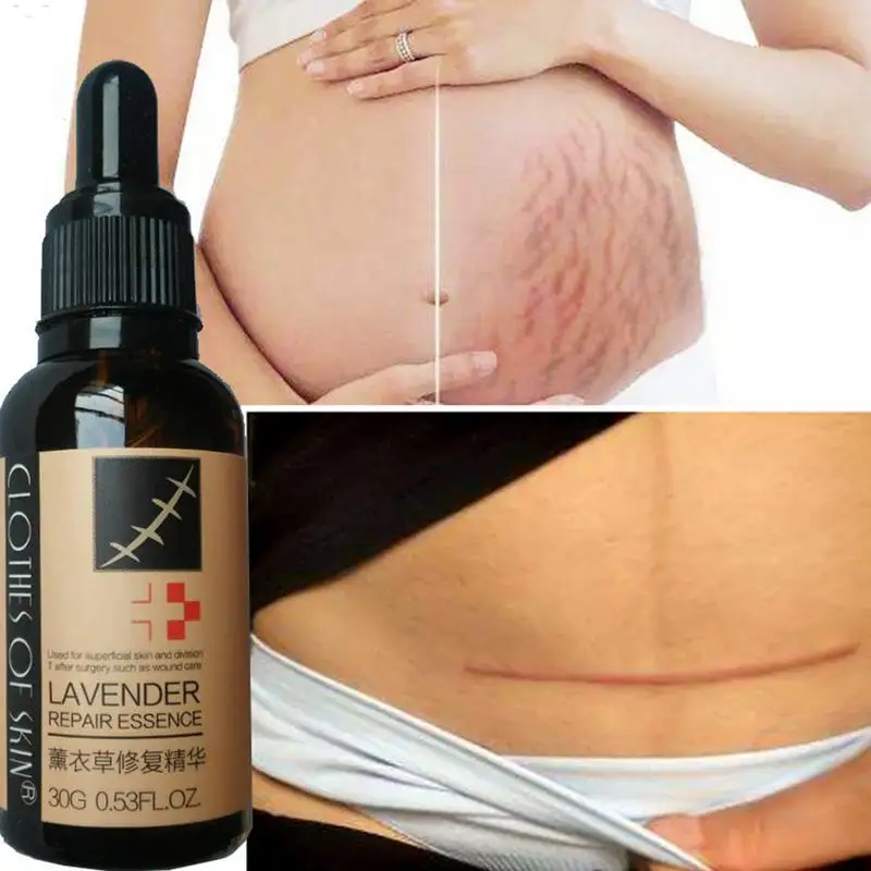 Эссенция лаванды для восстановления рубцов 30 г| |