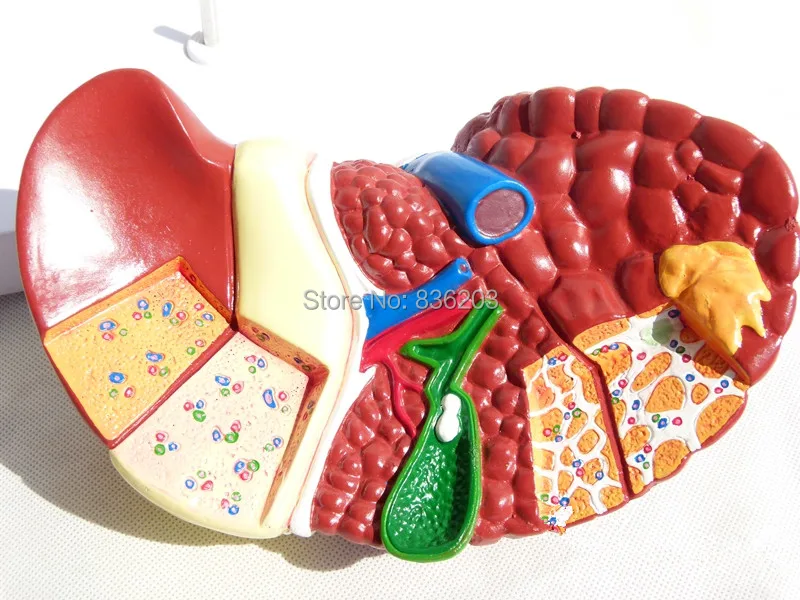 Модель патологии человека печенья с патологиями обучение анатомии медсестры
