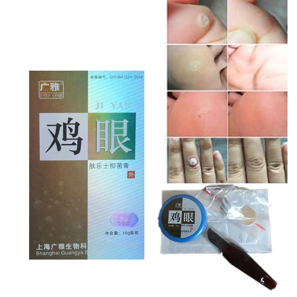 10g Effective Skin Tag Remover Natural Health Mole Nevus Wart Removal Foot Corn Warts Treatment Real massage D153 | Красота и
