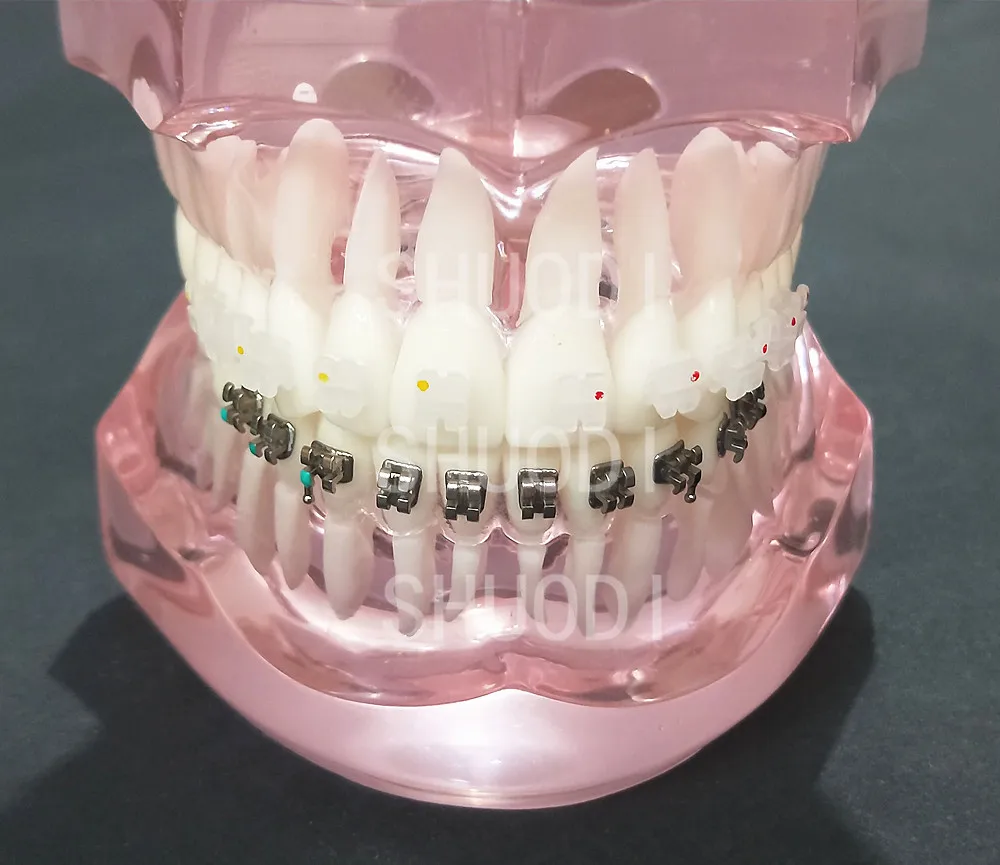 Pink 2 comparison Прозрачная Стоматологическая Ортодонтическая модель зубов с керамическими и металлическими кронштейнами для связи пациента - Цвет: Pink 2 comparison