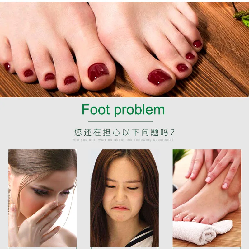 Foot Cream Remove Fungus Removal Relieve Itching Moisturizing Skin Cleaning Care MH88