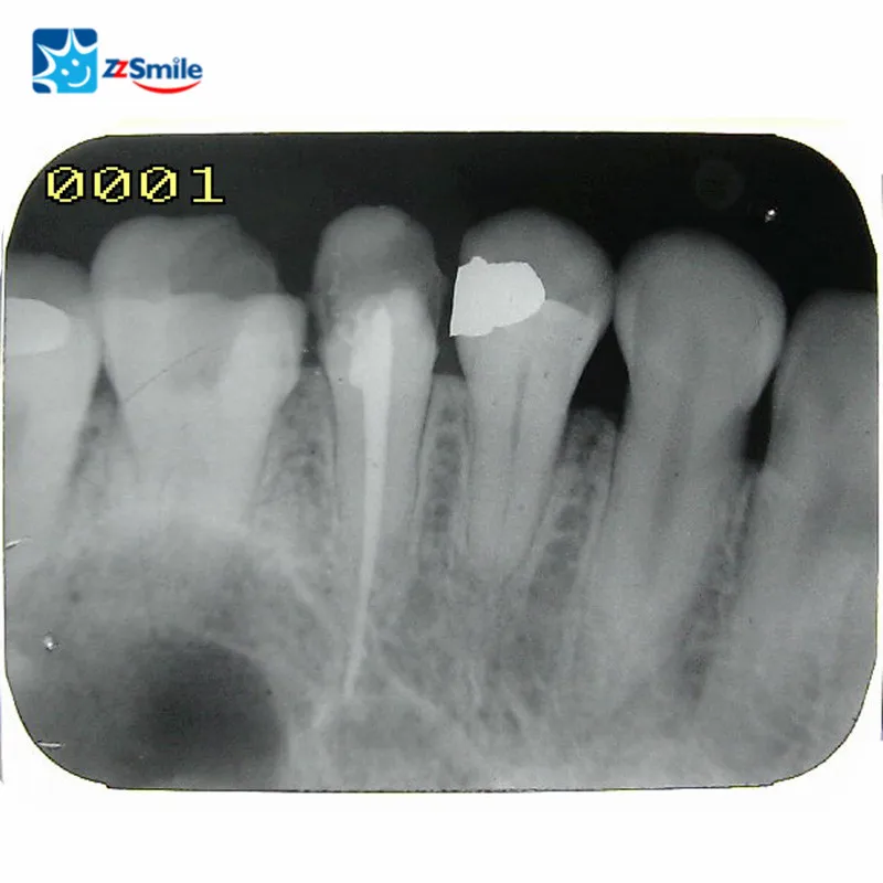 CE/FDA Approved 3-in-1 Multifunction M-168 Dental Intraoral Camera With 5" Monitor and Film Reader