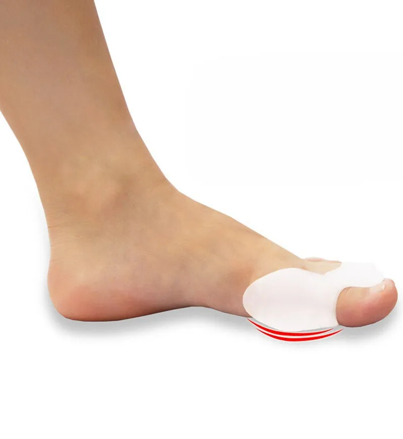 1 пара разделитель для пальцев ног при вальгусной деформации|foot care tool|care toolhallux valgus