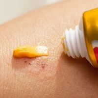 5pcs yiganerjing skin psoriasis cream skin anti atopic seborrheic eczematoid dermatitis rash eczema ointment with retail box 15g