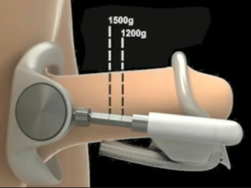 3rd Generation Male Stretcher Enlarger Proextender System Penes Enhancement Cock Male Enlargers Peni Maximum Pro Extender System