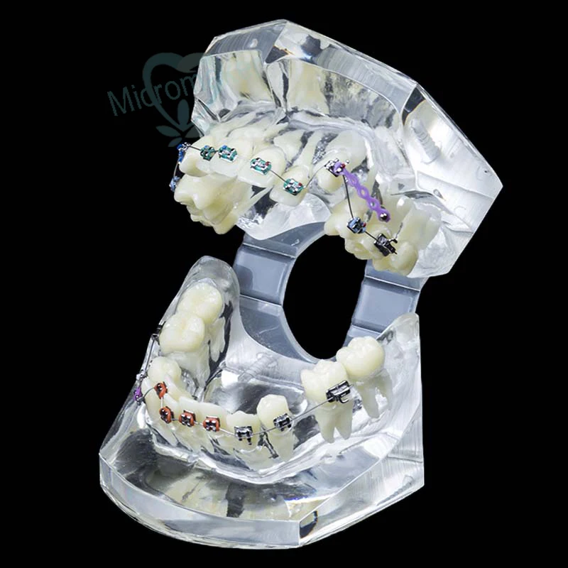 1 шт. Стоматологическая Ортодонтическая Исследование Научите зубы модель с