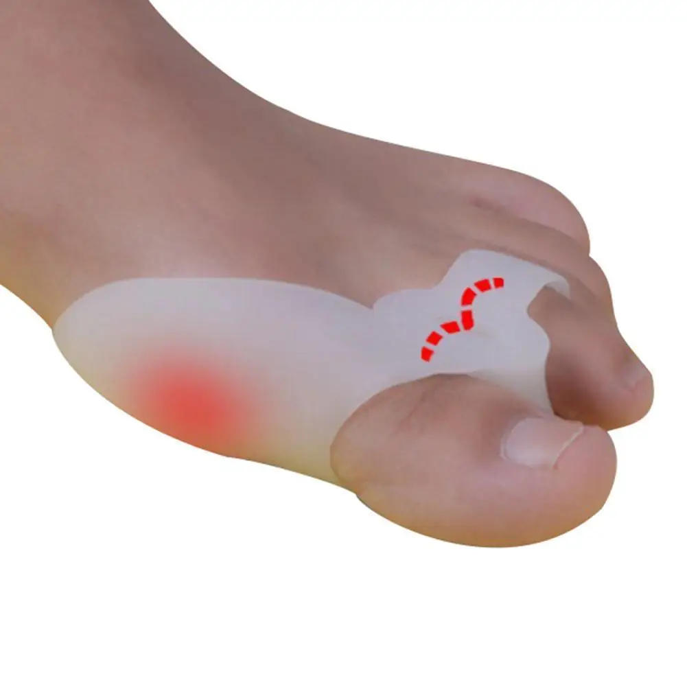 

SANWOOD 2Pcs Silicone Bunion Toes Corrector Orthotics Straightener Separator Ease Pain Relief Protect Your Bunion For Women