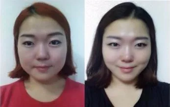 24 шт./12 упаковок накладки для похудения лица пластыри отек уменьшение отеков