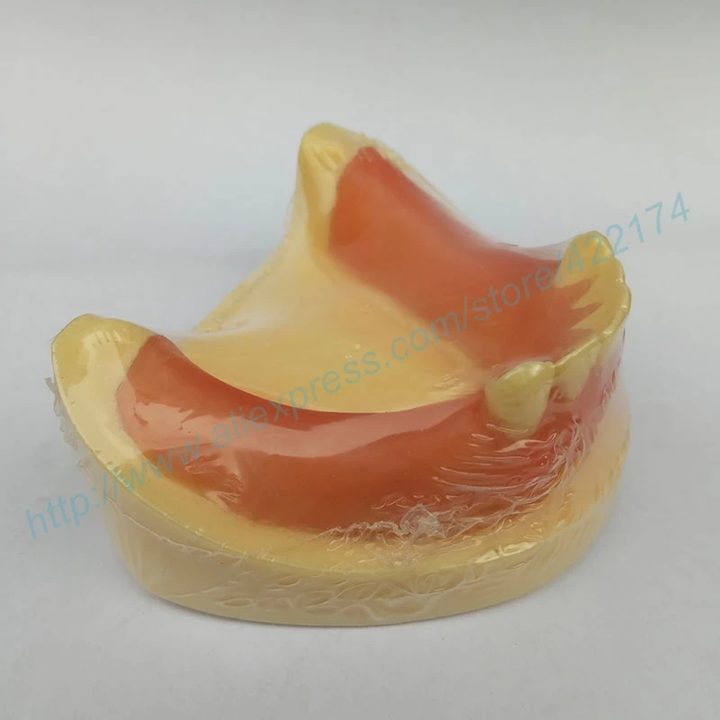 Бесплатная доставка модель для тренировки имплантации зубных зубов с деснами