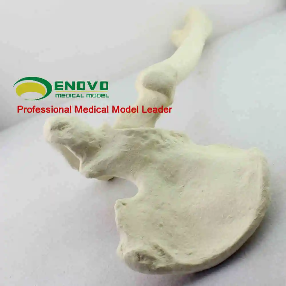 

Orthopedic surgery Sawbone orthopedics pfna operation Sawbone artificial cortical cancellous bone model