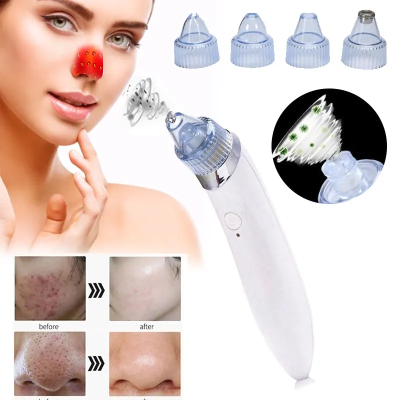 Очиститель черных точек быстрая очистка ABS модная белых акне эффективная красота