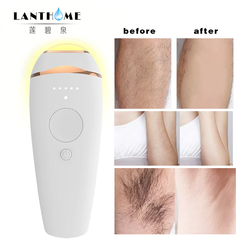 Ipl фото лазерный эпилятор устройства для удаления волос точка льда