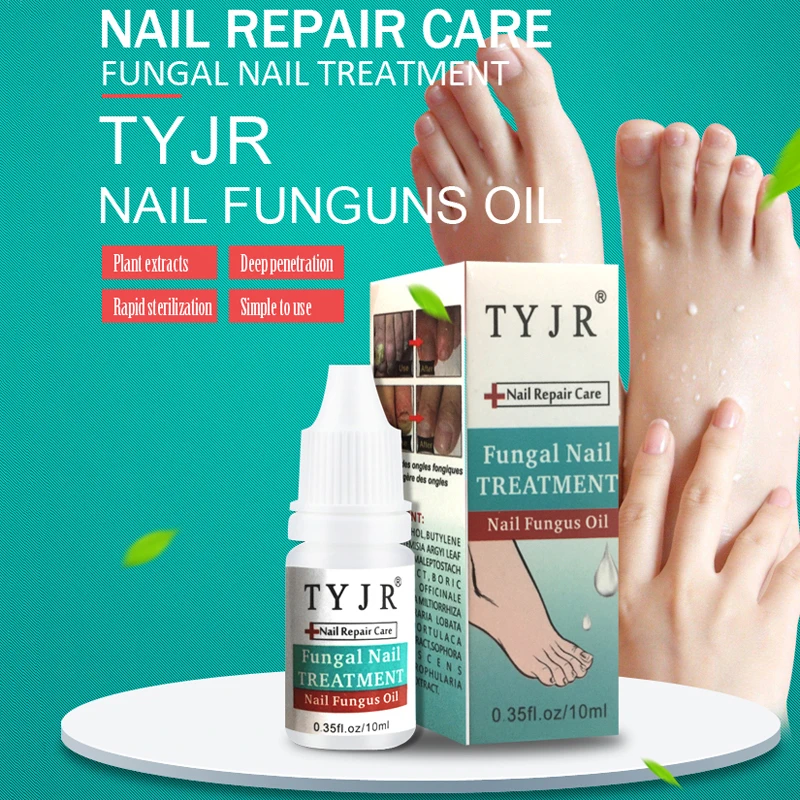 

Nail Treatment Essence Nail And Foot Whitening Toe Fungus Removal Feet Care Gel Onychomycosis Anti Fungal Nail Infection Liquid