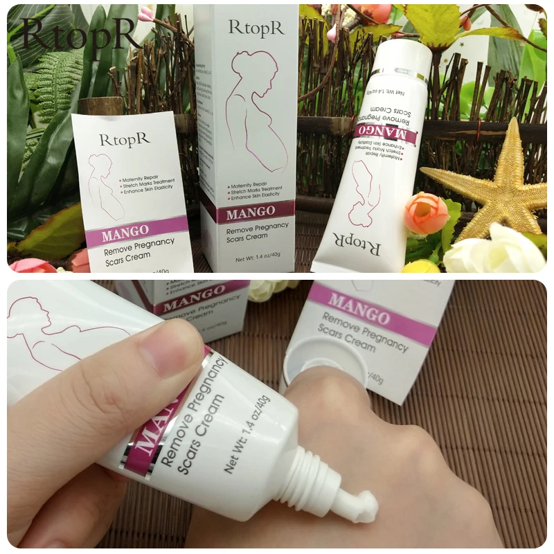 

RtopR Mango Remove Pregnancy Scars Acne Cream Stretch Marks Treatment Maternity Repair Anti-Aging Skin Firming Body Creams 40g