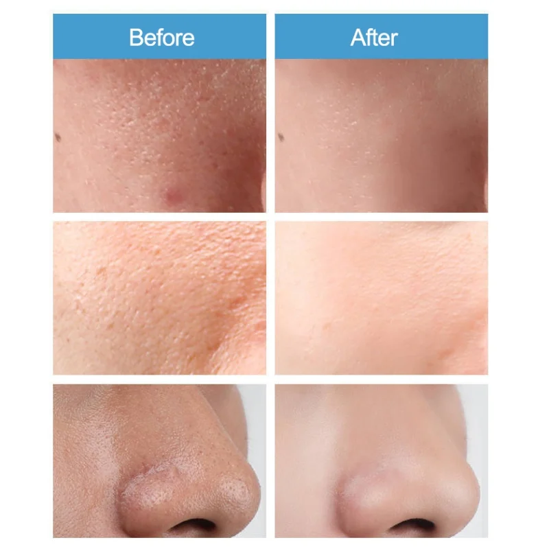 

New Shrink Pore Face Cream Anti-aging Dry skin Care Hyaluronic Acid Face Serum Moisturizing Whitening Essence