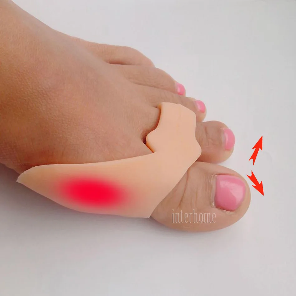 2 шт. инструмент для ухода за ногами силиконовый гель вальгусная деформация
