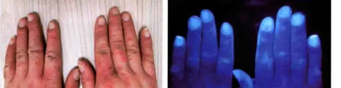 Новое поступление 2017 косметическое оборудование для ухода за кожей УФ лампа