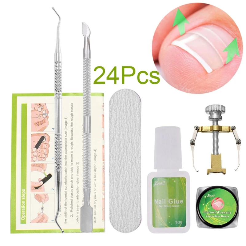 

Ingrown Toe Nail Correction Tool File Straightening Patch For Foot Care Kit