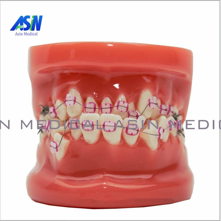 

Ортодонтическая модель зуба с керамическим кронштейном, модель врача, общения пациента, обучающая модель, стоматологические материалы