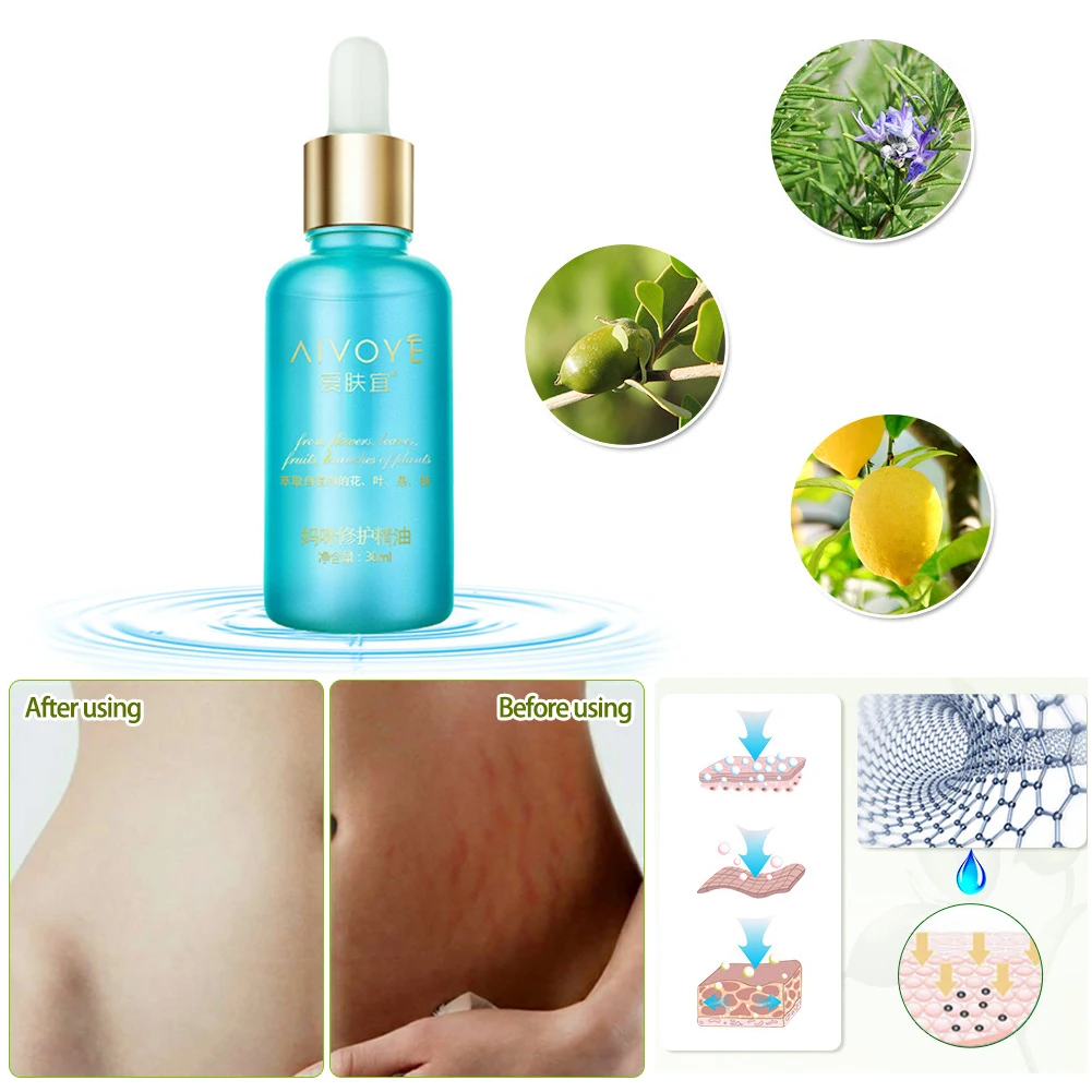 Шрамы после беременности крем для восстановления мамы для женщин Послеродовое восстановление удаление растяжек от ожирения Марка спа массаж эфирное масло