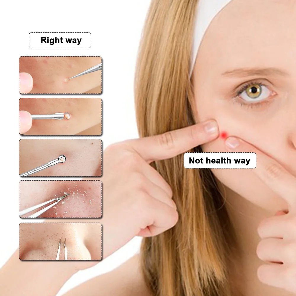 3 палочки для акне набор игл двойная головка сжимаемое кольцо изогнутый зажим рта